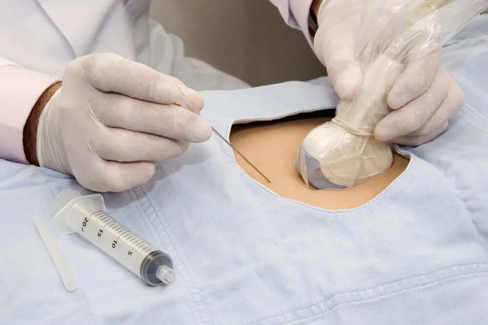 汕头彩超怎么样不再抓瞎！一篇文章带你读懂孕期排畸检查，看完记得收藏 ｜ 汕头妇产科医院_https://www.jmylbn.com_新闻资讯_第16张