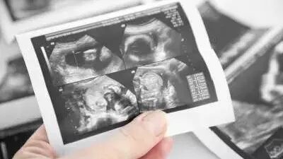 汕头彩超怎么样不再抓瞎！一篇文章带你读懂孕期排畸检查，看完记得收藏 ｜ 汕头妇产科医院_https://www.jmylbn.com_新闻资讯_第6张