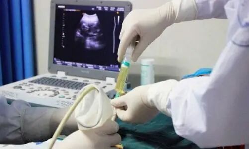 汕头彩超怎么样不再抓瞎！一篇文章带你读懂孕期排畸检查，看完记得收藏 ｜ 汕头妇产科医院_https://www.jmylbn.com_新闻资讯_第17张