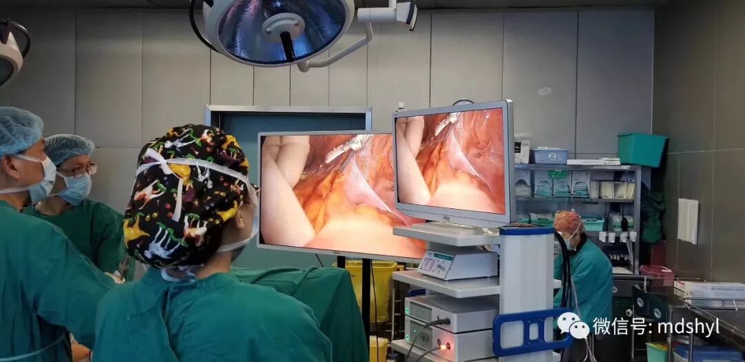 腹腔镜都有什么品牌德国艾克松XION｜｜超高清3D／4K腹腔镜系统_https://www.jmylbn.com_新闻资讯_第8张