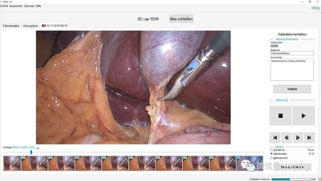 腹腔镜都有什么品牌德国艾克松XION｜｜超高清3D／4K腹腔镜系统_https://www.jmylbn.com_新闻资讯_第12张