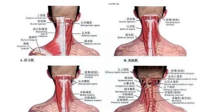 頸後大包如何系統康復糾正？ 健康 第9張