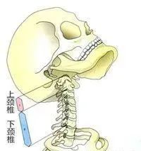 頸後大包如何系統康復糾正？ 健康 第5張