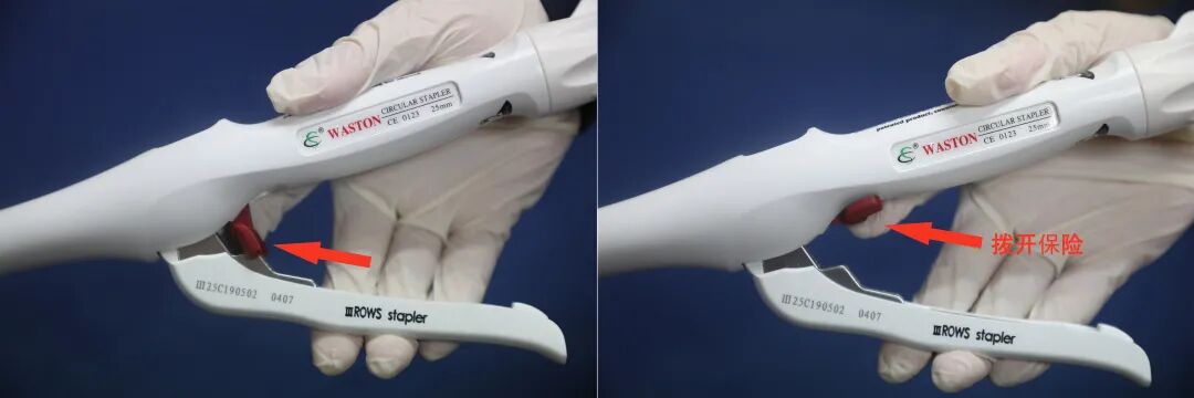 吻合器怎么用柳叶邂逅 ｜ 吻合器专题一：一次性使用管形吻合器操作要点_https://www.jmylbn.com_新闻资讯_第10张