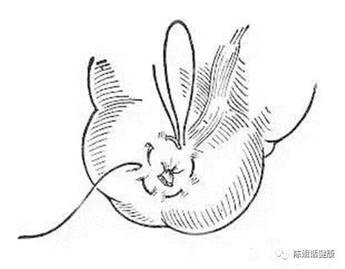 为什么要用皮钉缝合【经验分享】外科缝合法大全_https://www.jmylbn.com_新闻资讯_第10张