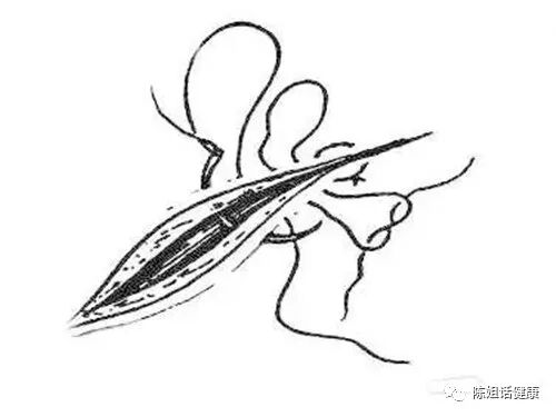 为什么要用皮钉缝合【经验分享】外科缝合法大全_https://www.jmylbn.com_新闻资讯_第13张