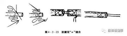 为什么要用皮钉缝合【经验分享】外科缝合法大全_https://www.jmylbn.com_新闻资讯_第20张
