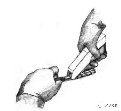 为什么要用皮钉缝合【经验分享】外科缝合法大全_https://www.jmylbn.com_新闻资讯_第21张