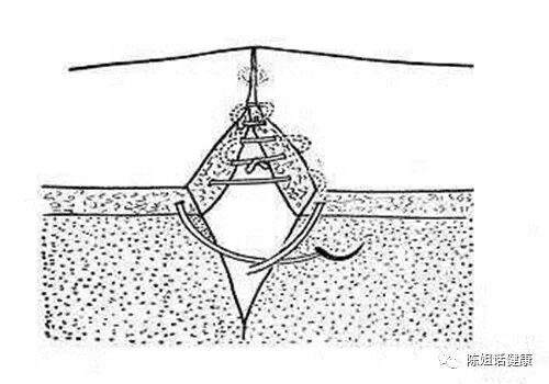 为什么要用皮钉缝合【经验分享】外科缝合法大全_https://www.jmylbn.com_新闻资讯_第16张