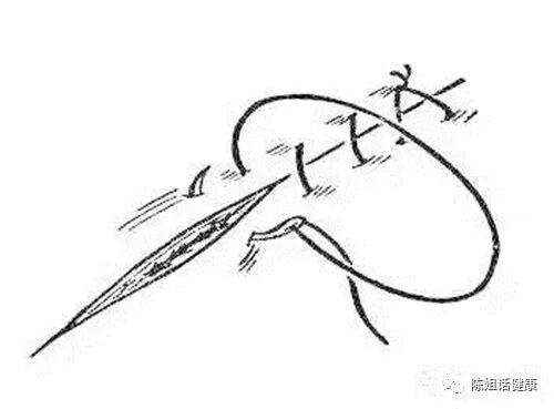 为什么要用皮钉缝合【经验分享】外科缝合法大全_https://www.jmylbn.com_新闻资讯_第3张