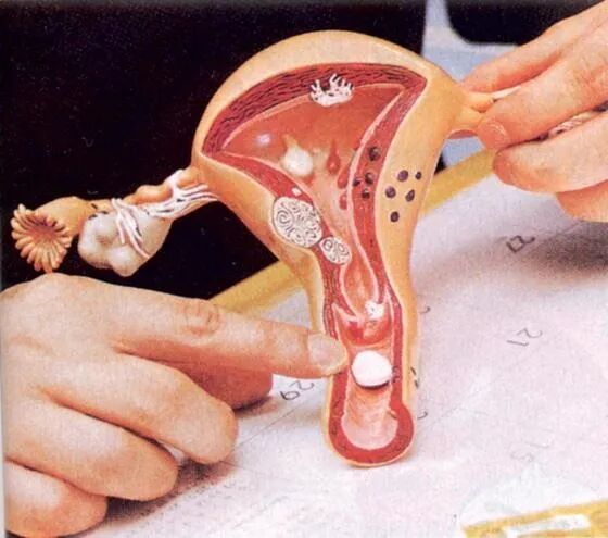 妇科脉冲怎么回事【激光科普】超脉冲CO2激光治疗阴道松弛_https://www.jmylbn.com_新闻资讯_第3张