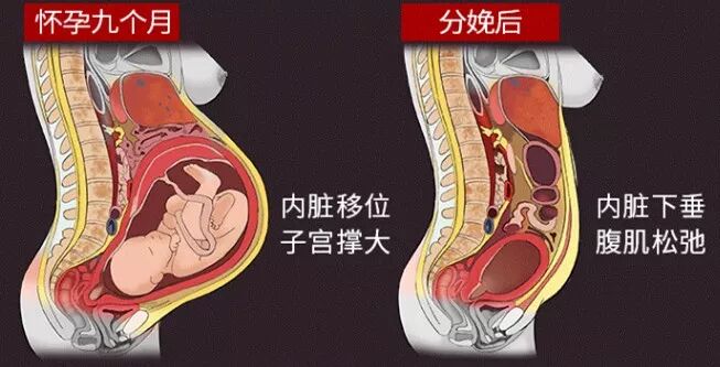 涨知识 || 收腹带能让你瘦下来么？