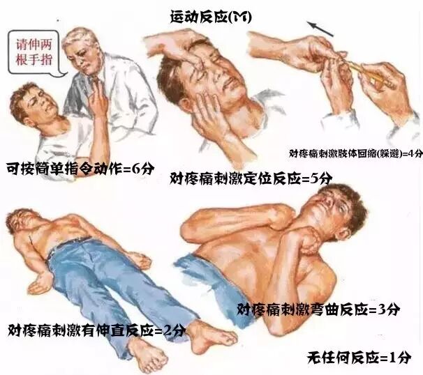 上肢夹板怎么用干货：临床常见各种创伤急救措施_https://www.jmylbn.com_新闻资讯_第31张