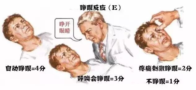 上肢夹板怎么用干货：临床常见各种创伤急救措施_https://www.jmylbn.com_新闻资讯_第29张