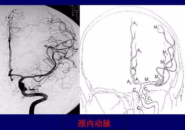 脑血管造影解剖_医学界-助力医生临床决策和职业成长