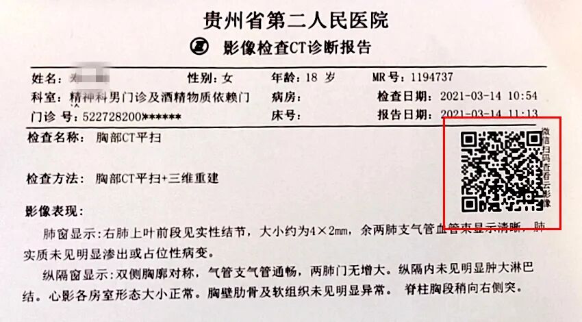 DR影像怎么重新上传省二医影像科DR（照片）、CT、MRI（核磁）检查流程及注意事项_https://www.jmylbn.com_新闻资讯_第10张
