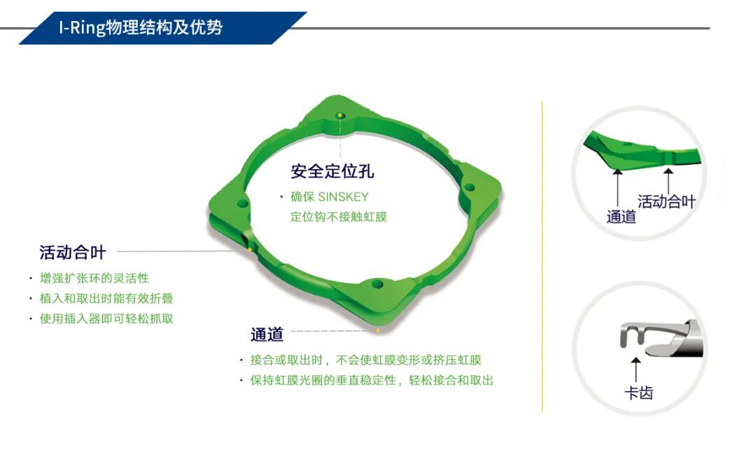 Visitec® I-Ring®预装式虹膜扩张器确保小瞳孔眼科手术的安全顺利进行