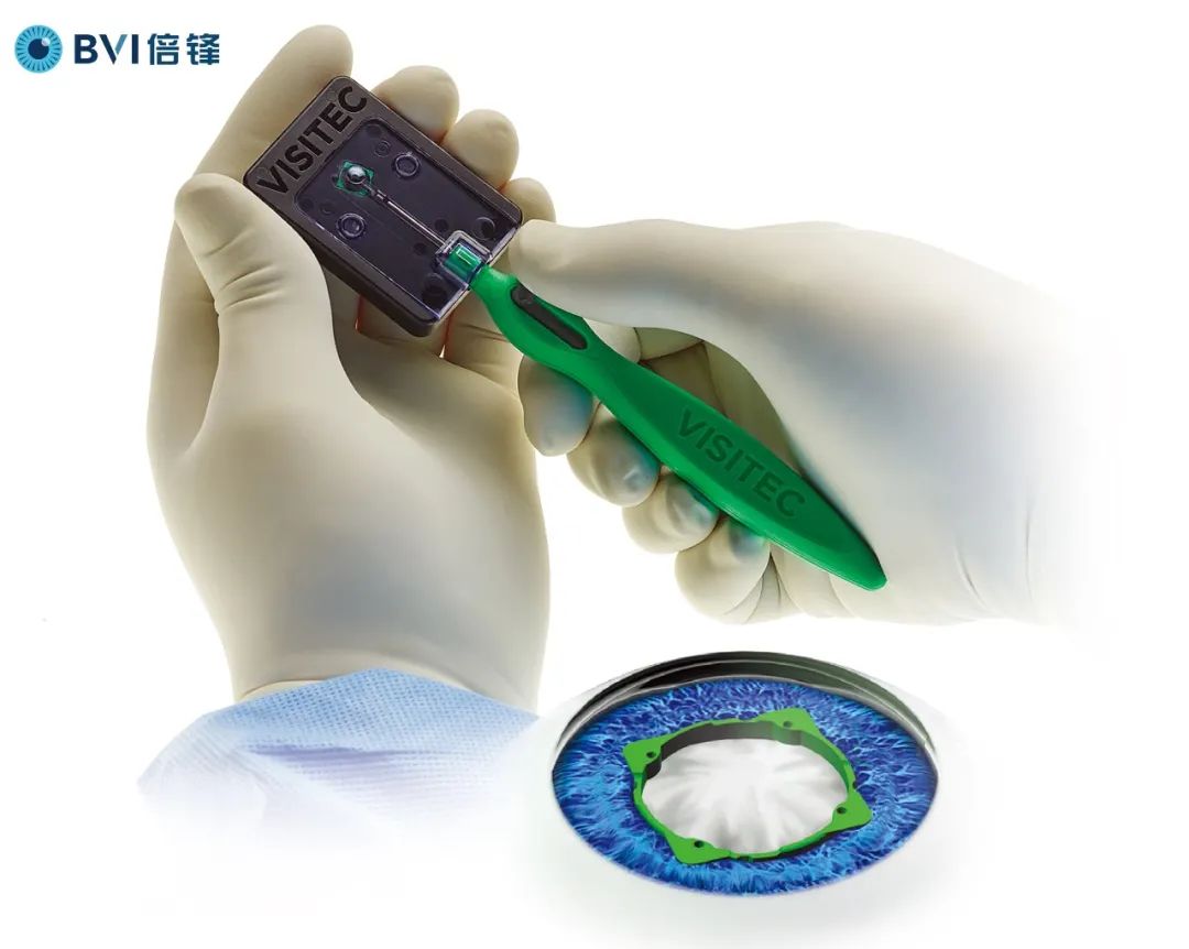 Visitec® I-Ring®预装式虹膜扩张器确保小瞳孔眼科手术的安全顺利进行