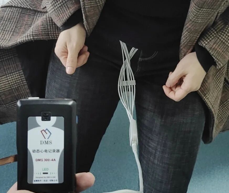 动态心电图自己怎么记录24小时动态心电图，做还是不做？_https://www.jmylbn.com_新闻资讯_第9张