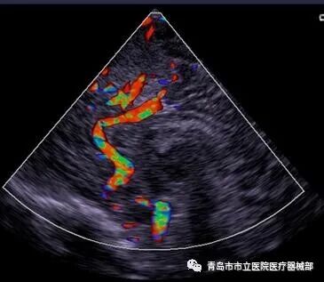 什么叫超声容积探头医学超声成像原理及设备维护（一）_https://www.jmylbn.com_新闻资讯_第22张