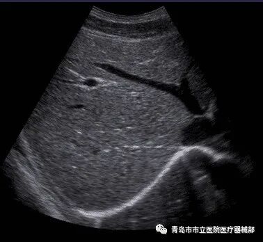 什么叫超声容积探头医学超声成像原理及设备维护（一）_https://www.jmylbn.com_新闻资讯_第8张