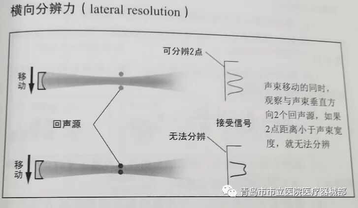 什么叫超声容积探头医学超声成像原理及设备维护（一）_https://www.jmylbn.com_新闻资讯_第3张