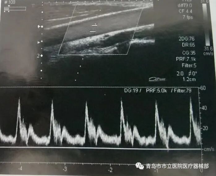 什么叫超声容积探头医学超声成像原理及设备维护（一）_https://www.jmylbn.com_新闻资讯_第20张