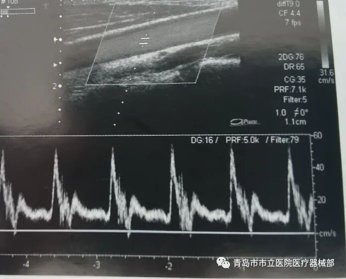 什么叫超声容积探头医学超声成像原理及设备维护（一）_https://www.jmylbn.com_新闻资讯_第19张