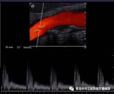 什么叫超声容积探头医学超声成像原理及设备维护（一）_https://www.jmylbn.com_新闻资讯_第23张