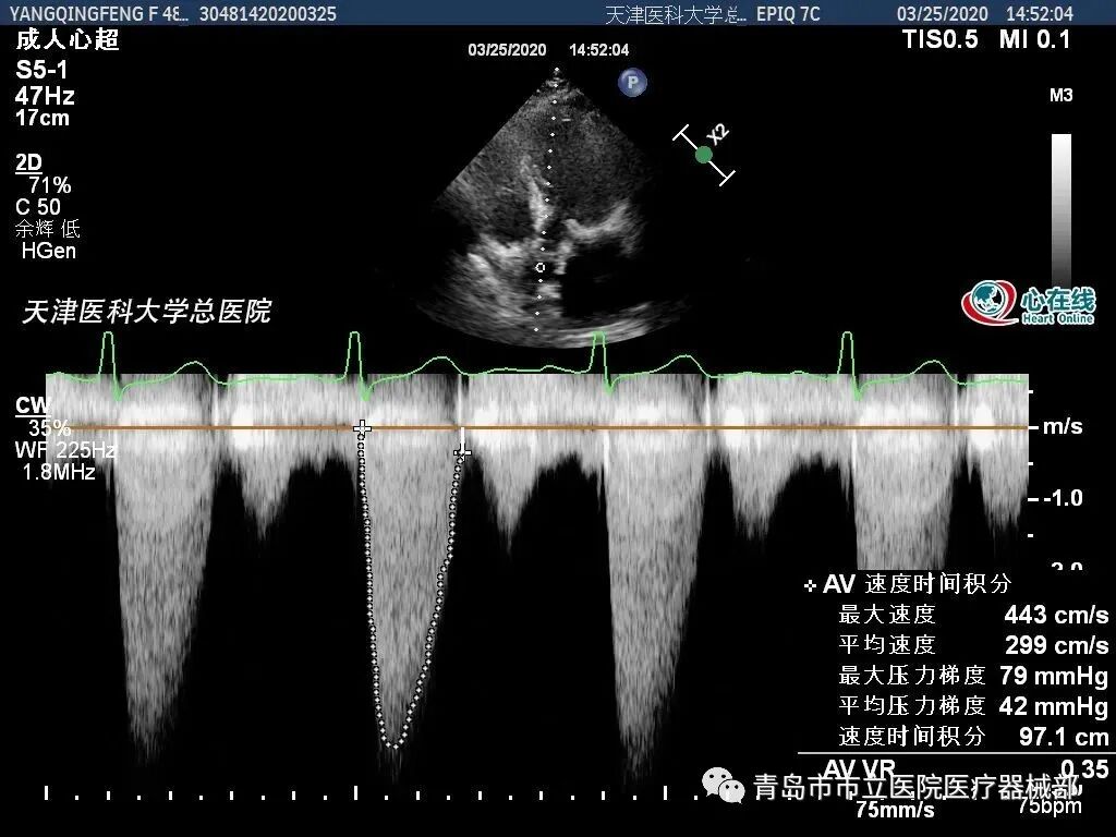什么叫超声容积探头医学超声成像原理及设备维护（一）_https://www.jmylbn.com_新闻资讯_第16张