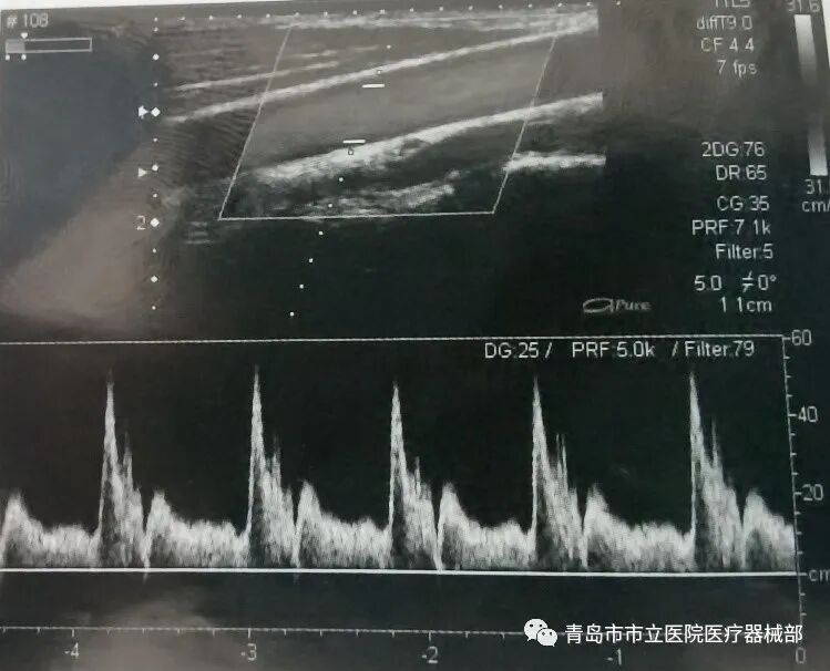 什么叫超声容积探头医学超声成像原理及设备维护（一）_https://www.jmylbn.com_新闻资讯_第21张