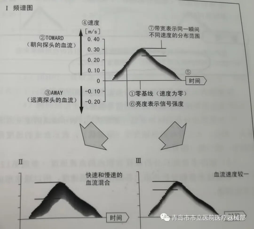 什么叫超声容积探头医学超声成像原理及设备维护（一）_https://www.jmylbn.com_新闻资讯_第18张
