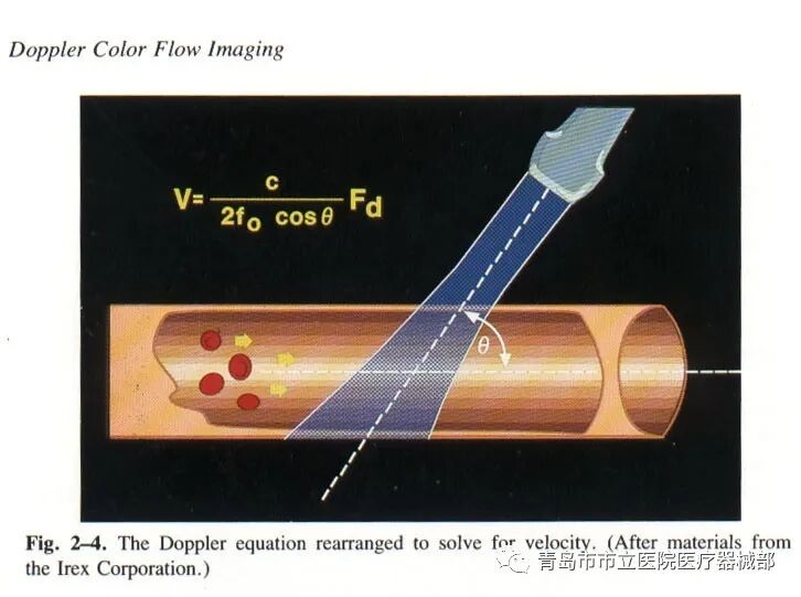 什么叫超声容积探头医学超声成像原理及设备维护（一）_https://www.jmylbn.com_新闻资讯_第14张