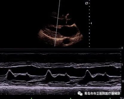 什么叫超声容积探头医学超声成像原理及设备维护（一）_https://www.jmylbn.com_新闻资讯_第10张