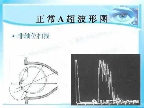 什么叫超声容积探头医学超声成像原理及设备维护（一）_https://www.jmylbn.com_新闻资讯_第7张
