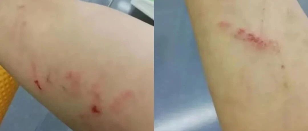 被家暴的男人不敢求助……“一个男的，你说你被老婆打，会被笑话的”