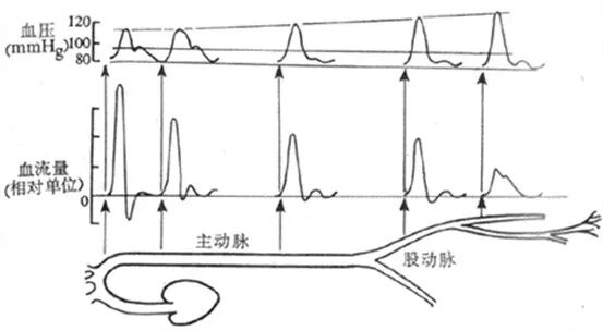 压力波是什么波有创动脉血压监测方法及波形解析_https://www.jmylbn.com_新闻资讯_第6张