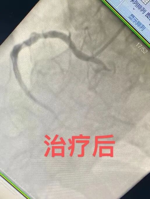 dsa是什么设备沭阳百姓的健康福音——国际高端设备西门子数字减影血管造影机（DSA）你了解多少？_https://www.jmylbn.com_新闻资讯_第14张