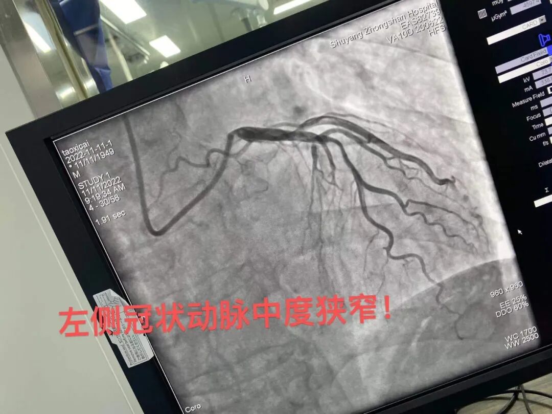 dsa是什么设备沭阳百姓的健康福音——国际高端设备西门子数字减影血管造影机（DSA）你了解多少？_https://www.jmylbn.com_新闻资讯_第16张