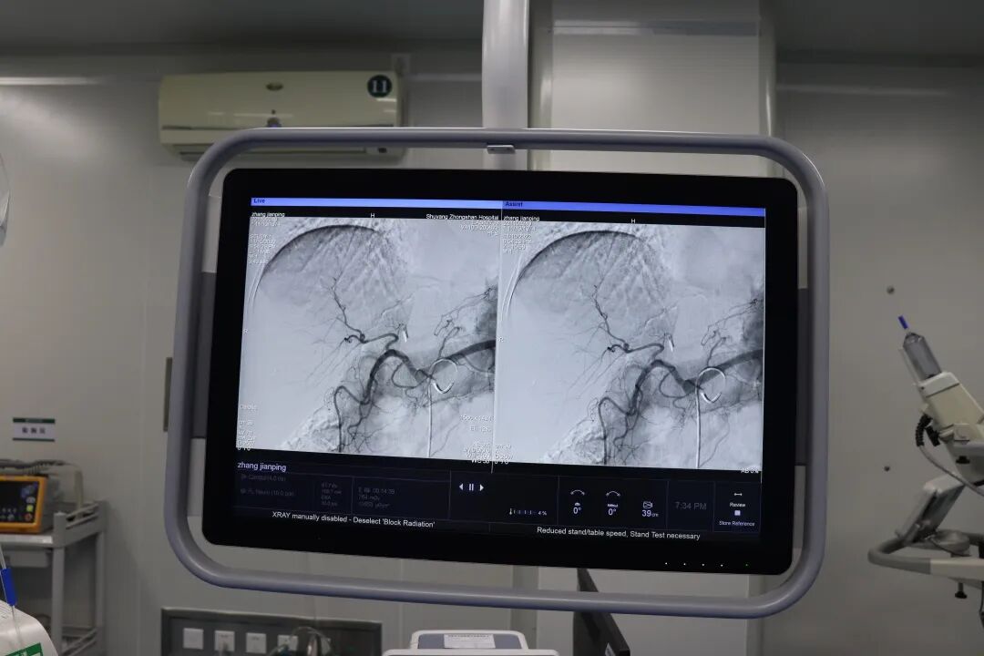 dsa是什么设备沭阳百姓的健康福音——国际高端设备西门子数字减影血管造影机（DSA）你了解多少？_https://www.jmylbn.com_新闻资讯_第2张