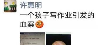 又因为做作业！男孩被紧急送医！检查结果令人痛惜！家长这个习惯请一定改掉