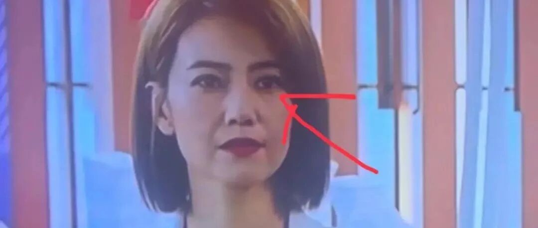 高圆圆脸上胶原蛋白没了，泪沟法令纹都很深，不美颜是老阿姨了！