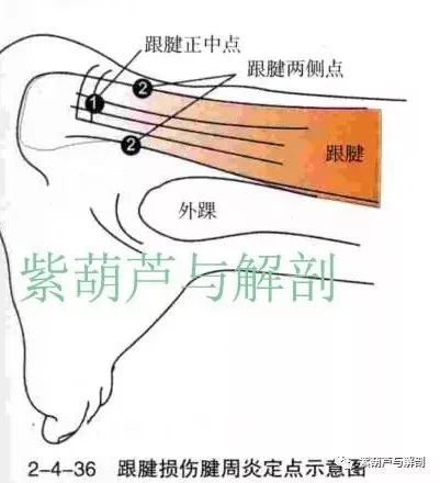 跟腱损伤及跟腱周围炎 紫葫芦与解剖 微信公众号文章阅读 Wemp