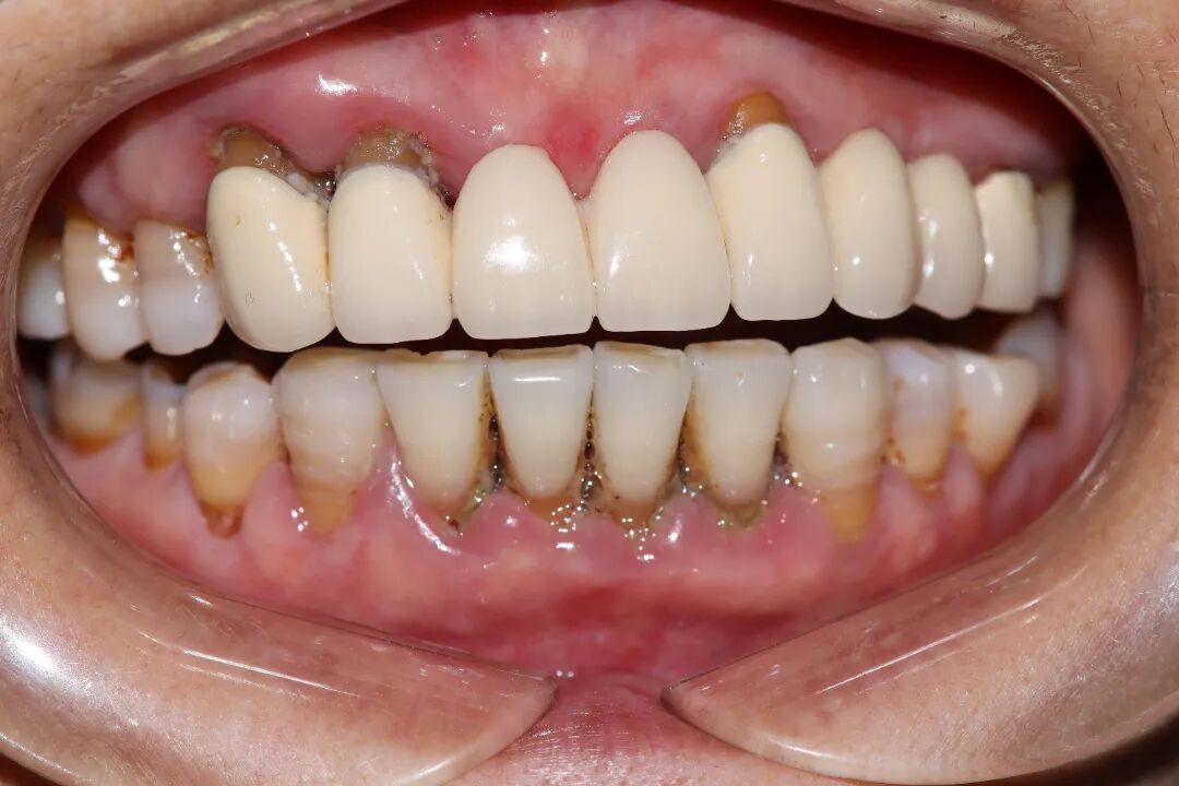 口腔内窥镜怎么用牙周内窥镜，呵护口腔健康_https://www.jmylbn.com_新闻资讯_第10张