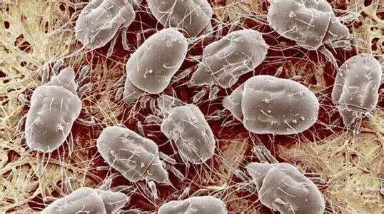 螨虫肉眼能看到吗_螨虫肉眼可以见到吗_能肉眼螨虫看到吗