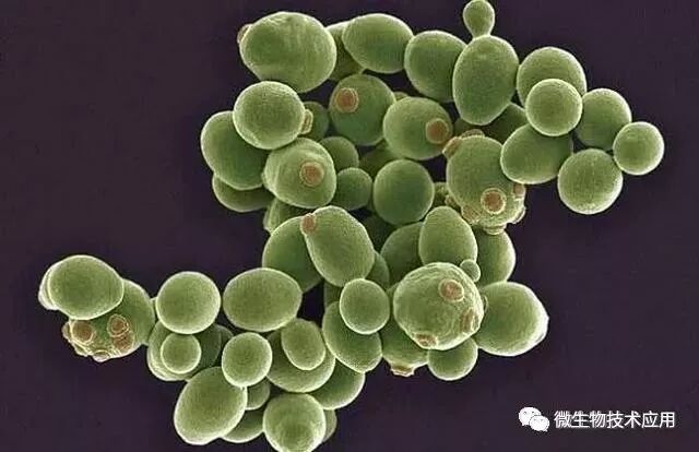 微生物发酵的工作流程及应用范围