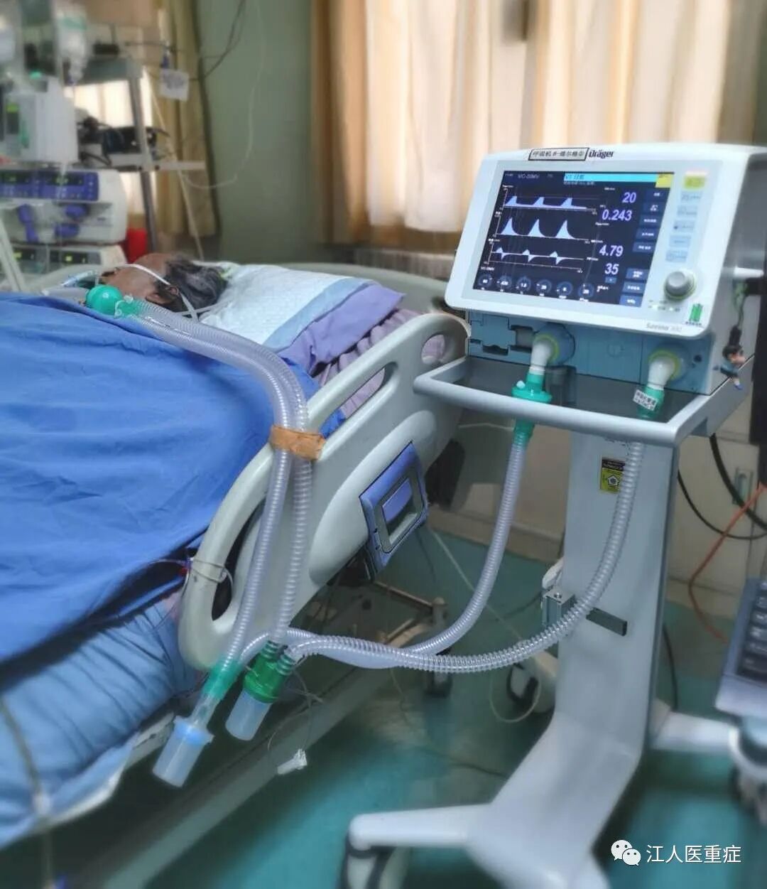 呼吸机怎么看自主呼吸呼吸机撤机的细节和流程_https://www.jmylbn.com_新闻资讯_第1张