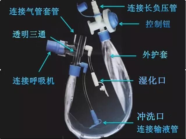 为什么使用密闭式吸痰管密闭式吸痰技术三两事_https://www.jmylbn.com_新闻资讯_第2张