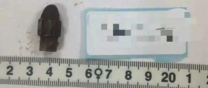 笔帽、蜡笔、水果...这都能“塞”进身体？细思极恐！