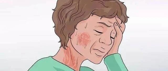 郁琦教授：打破绝经认识误区，激素治疗并不可怕